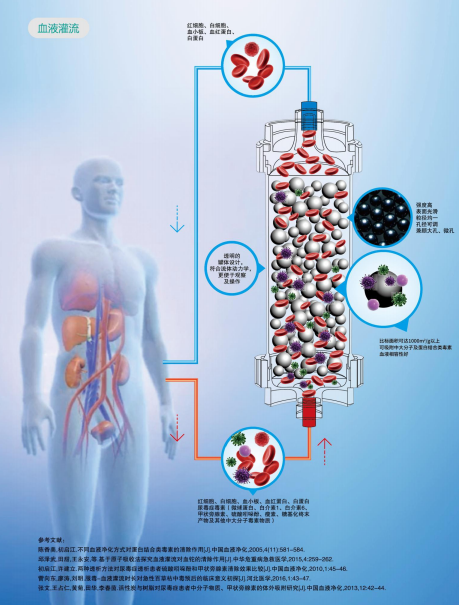 希尔康-RC血液灌流器
